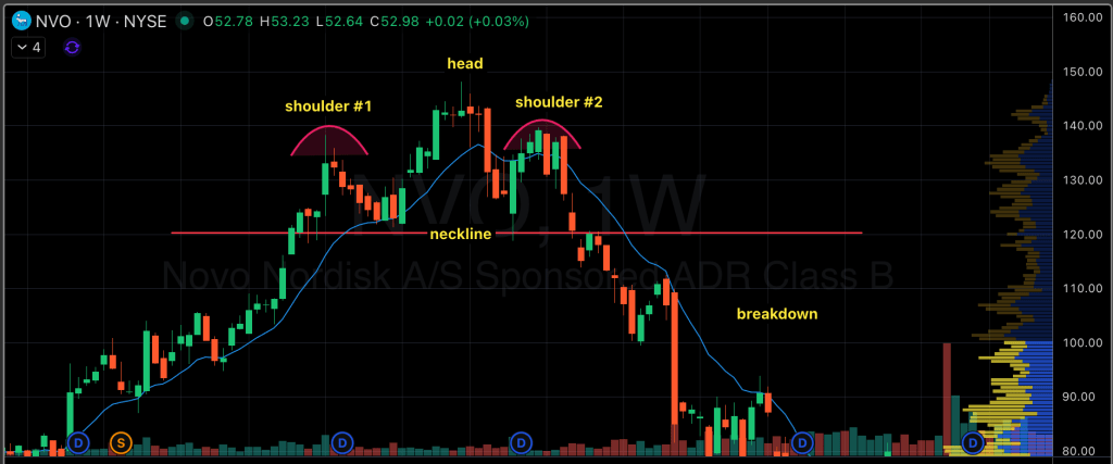 Real World Head & Shoulders Pattern